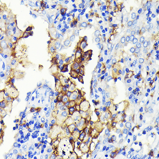 CD14 Rabbit monoclonal antibody