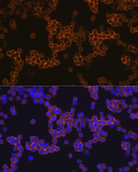 CD14 Rabbit monoclonal antibody