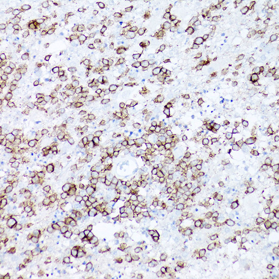 CD19 Rabbit monoclonal antibody