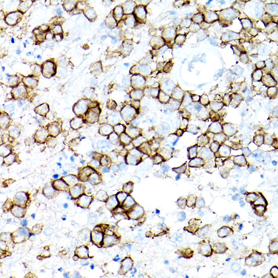 CD19 Rabbit monoclonal antibody