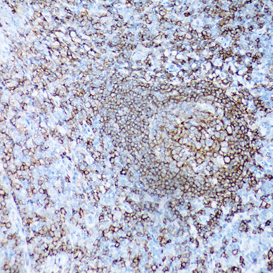CD19 Rabbit monoclonal antibody