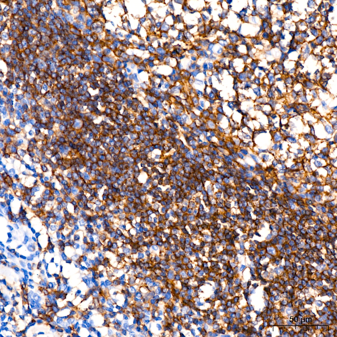 CD19 Rabbit monoclonal antibody