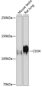 CD34 Rabbit monoclonal antibody