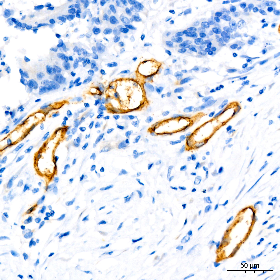CD34 Rabbit monoclonal antibody