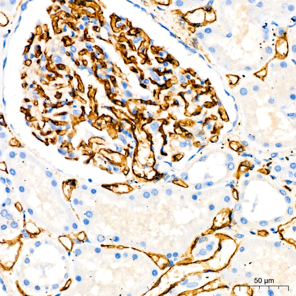 CD34 Rabbit monoclonal antibody