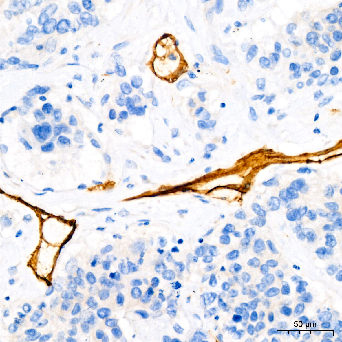 CD34 Rabbit monoclonal antibody