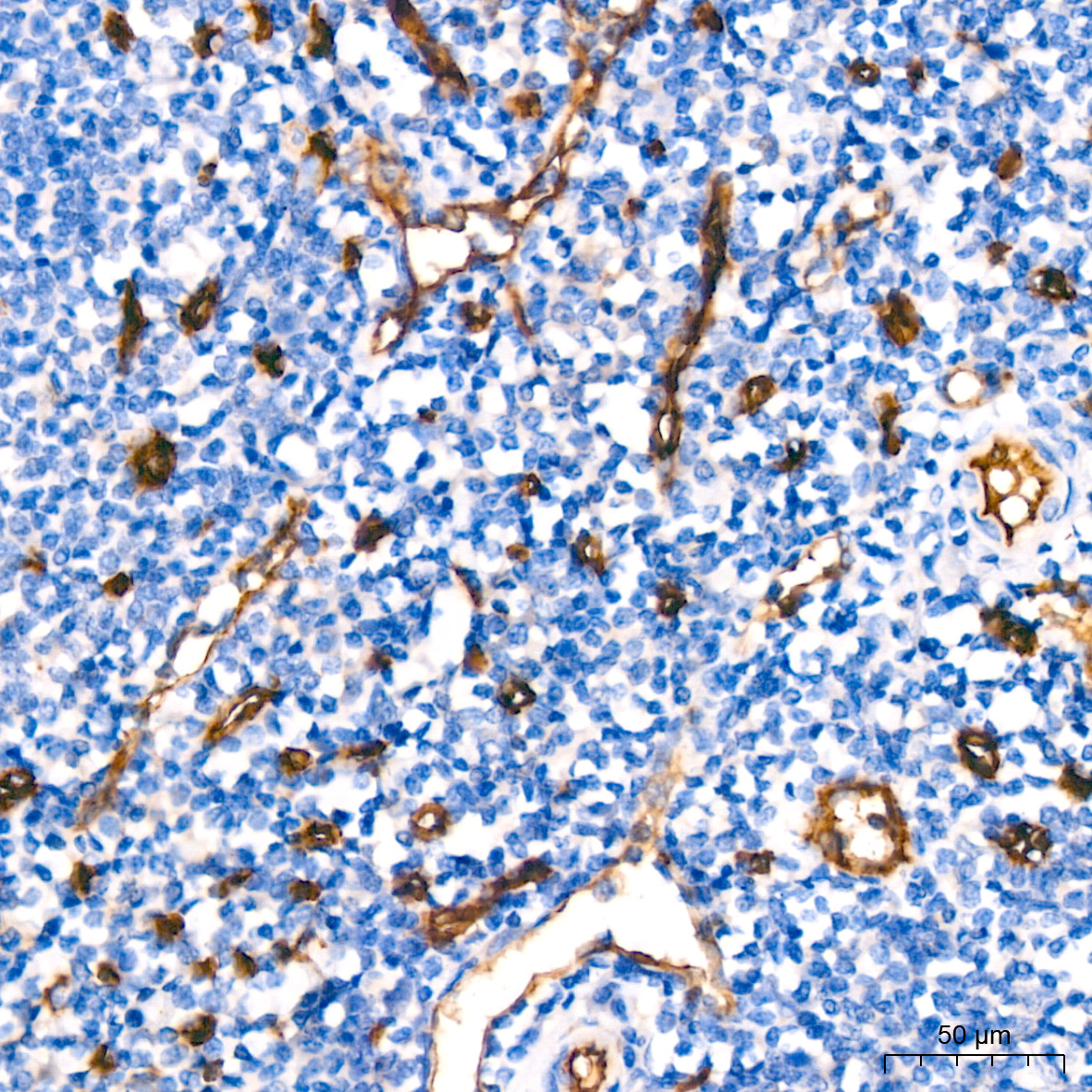 CD34 Rabbit monoclonal antibody