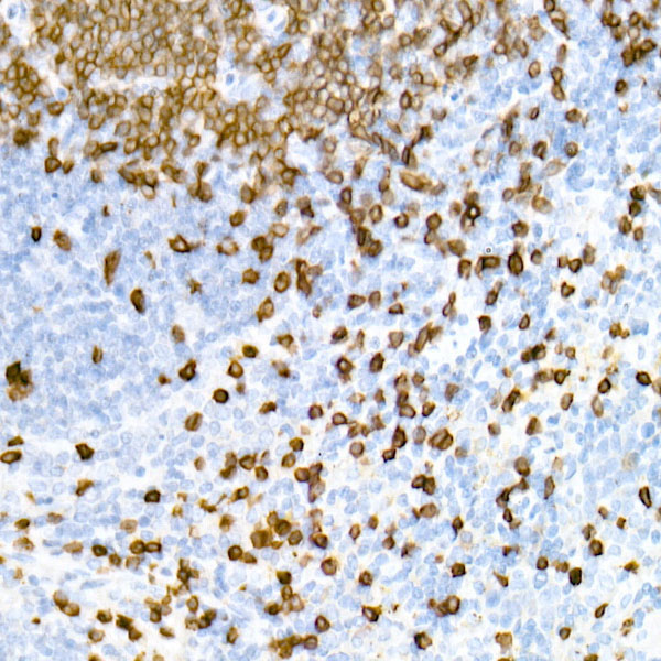 CD3E Rabbit monoclonal antibody