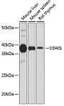 Western blot - CD40L Rabbit mAb (A19019)