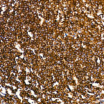 Western blot - CD45 Rabbit mAb (A19021)