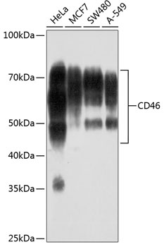 CD46 Rabbit monoclonal antibody