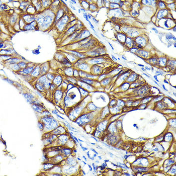 CD46 Rabbit monoclonal antibody