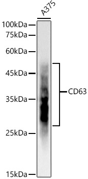 CD63 Rabbit monoclonal antibody