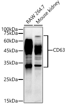 CD63 Rabbit monoclonal antibody