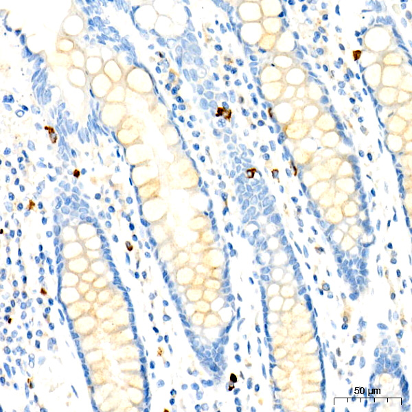 CD63 Rabbit monoclonal antibody