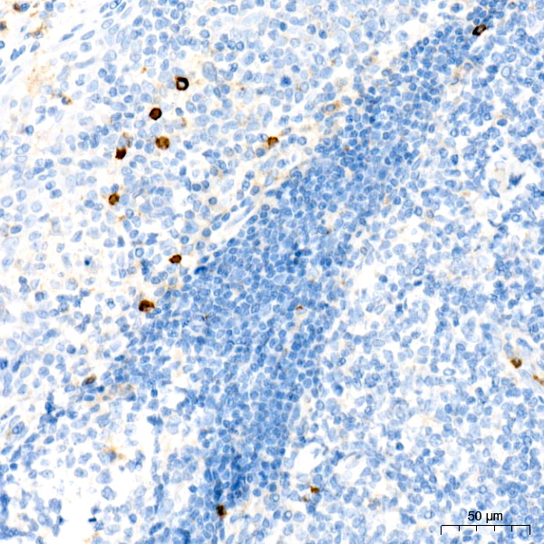 CD63 Rabbit monoclonal antibody