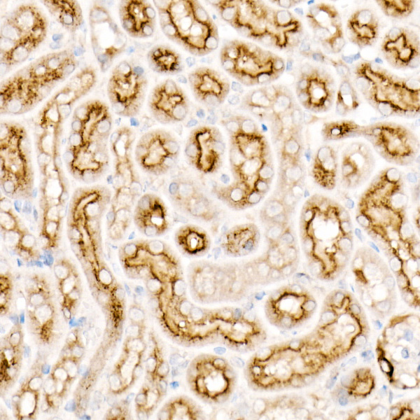 CD63 Rabbit monoclonal antibody