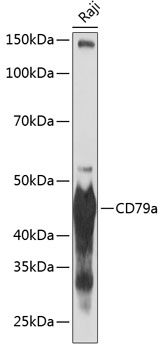 CD79a Rabbit monoclonal antibody
