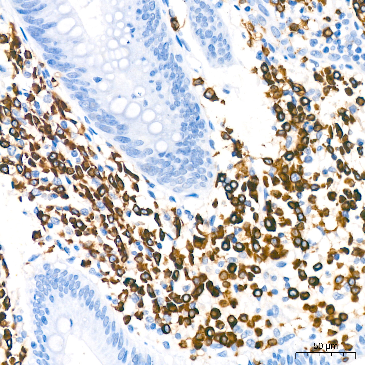 CD79a Rabbit monoclonal antibody