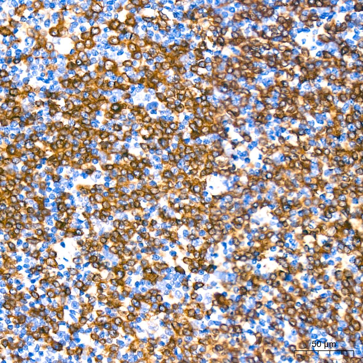 CD79a Rabbit monoclonal antibody