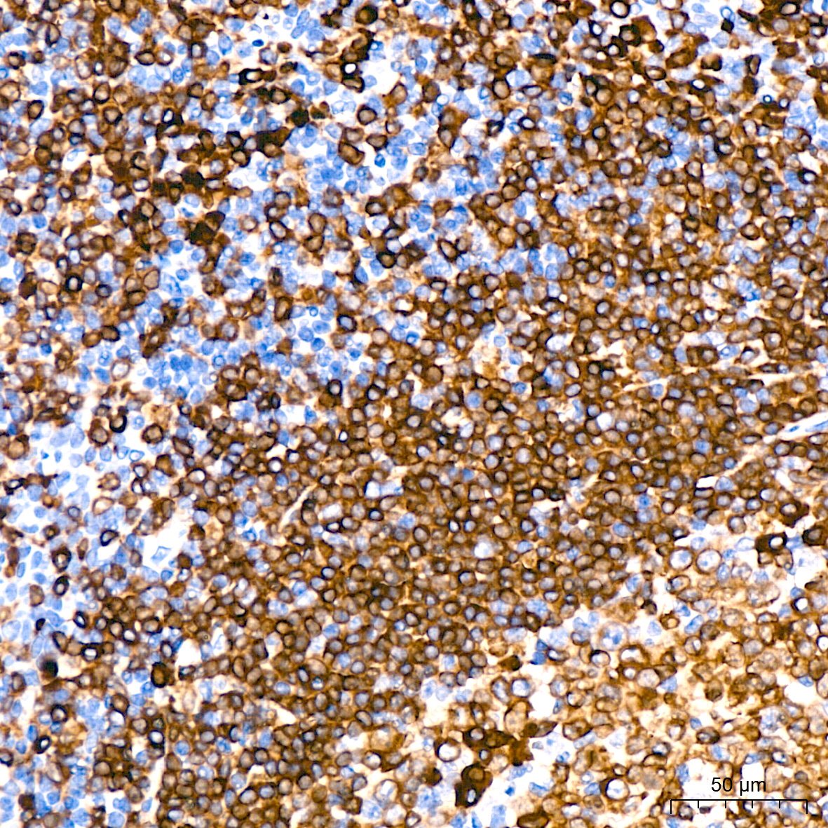 CD79a Rabbit monoclonal antibody