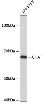 ChAT Rabbit monoclonal antibody