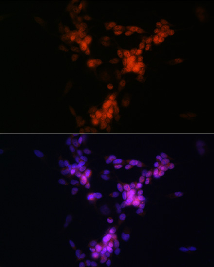ChAT Rabbit monoclonal antibody