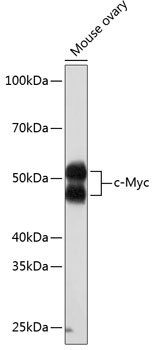 [KO Validated] c-Myc Rabbit monoclonal antibody