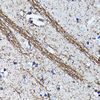 CNPase Rabbit monoclonal antibody