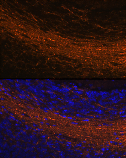 CNPase Rabbit monoclonal antibody