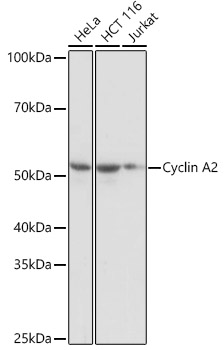 Cyclin A2 Rabbit monoclonal antibody