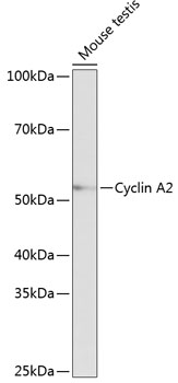 Cyclin A2 Rabbit monoclonal antibody