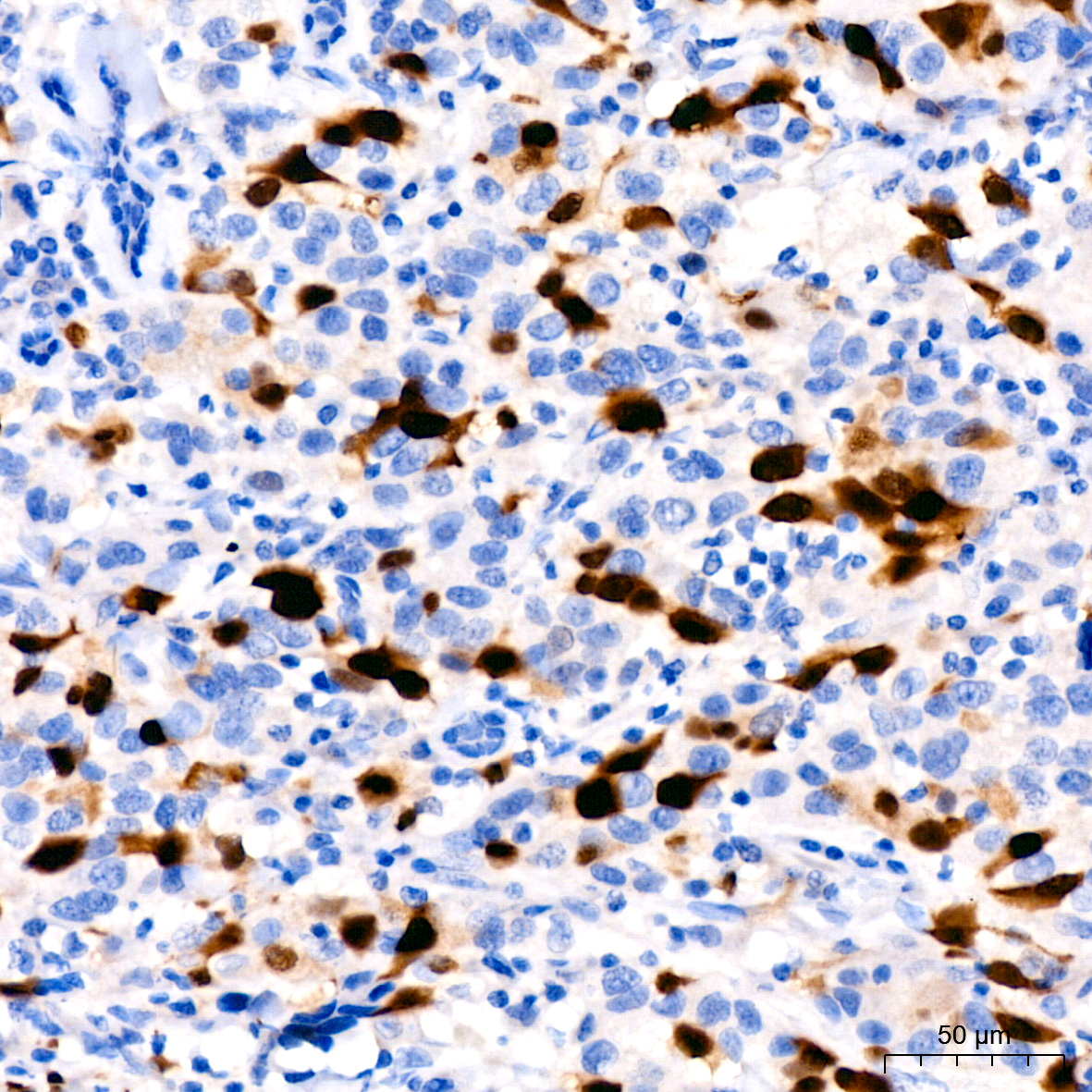 Cyclin A2 Rabbit monoclonal antibody