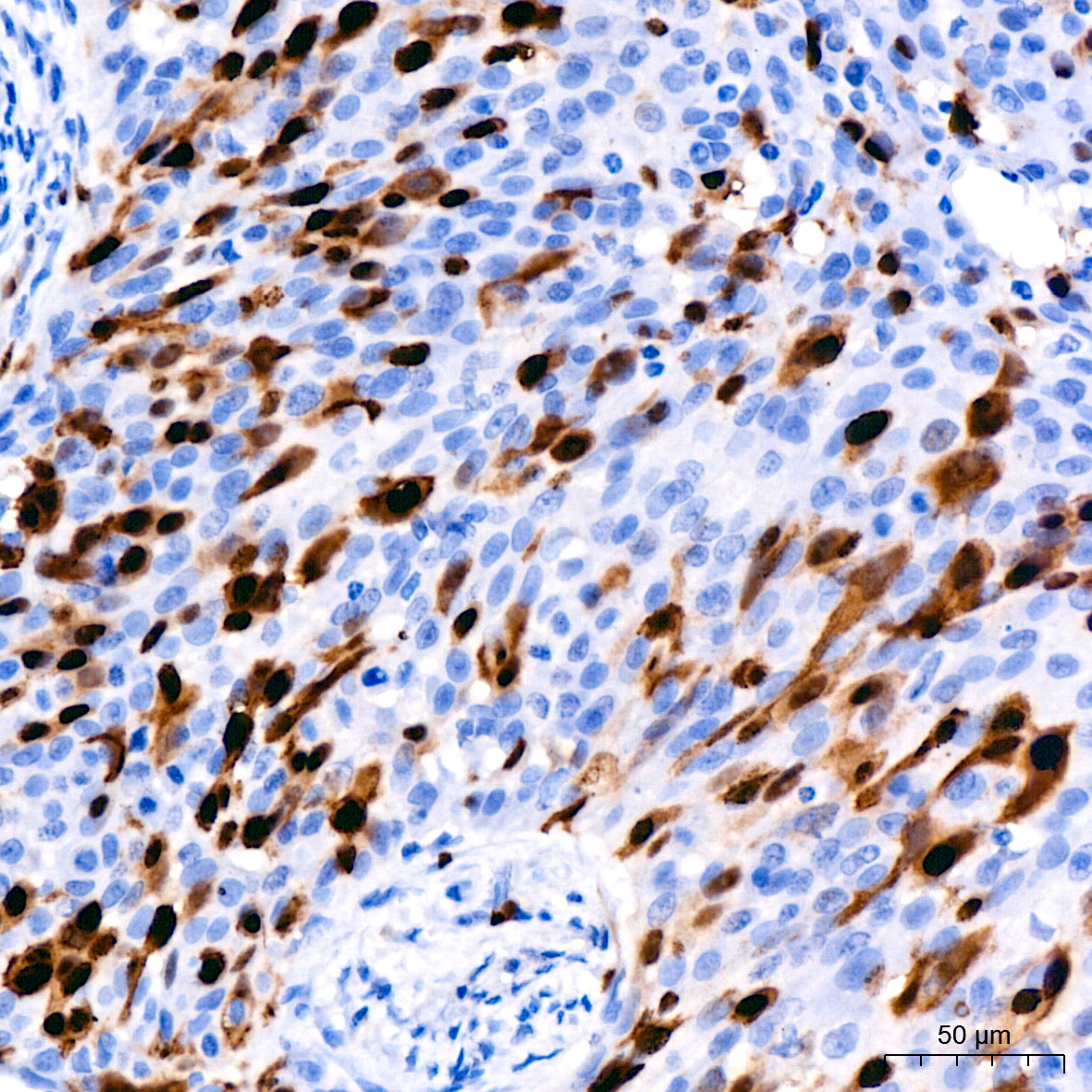Cyclin A2 Rabbit monoclonal antibody