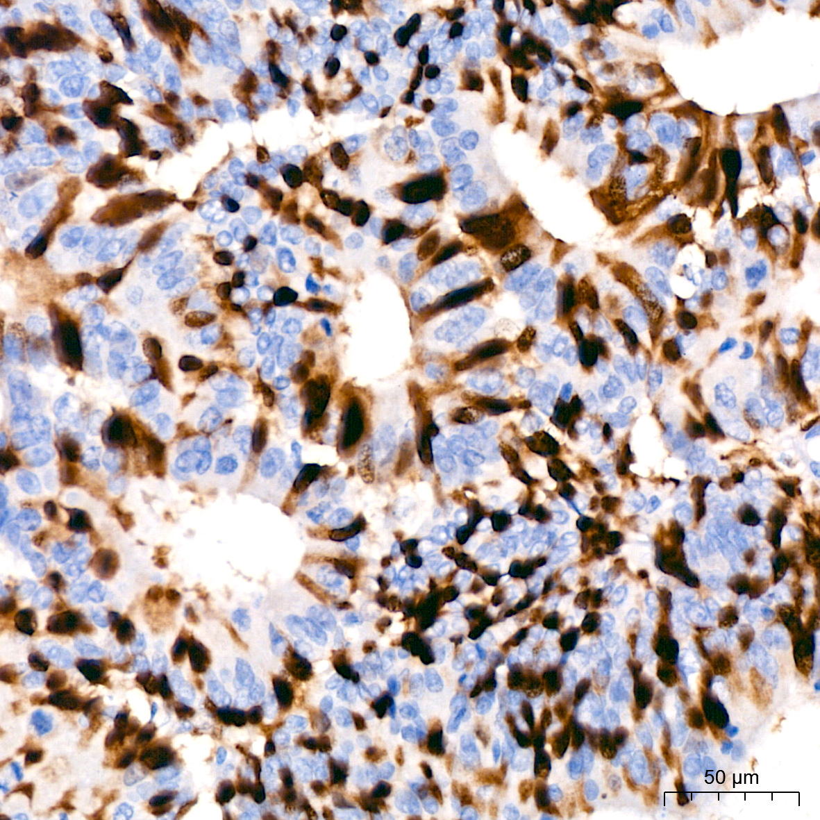 Cyclin A2 Rabbit monoclonal antibody