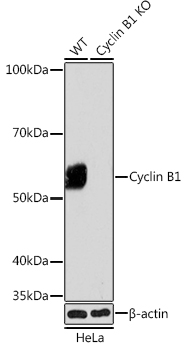 [KO Validated] Cyclin B1 Rabbit monoclonal antibody