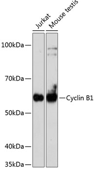 [KO Validated] Cyclin B1 Rabbit monoclonal antibody