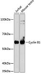 Western blot - [KO Validated] Cyclin B1 Rabbit mAb (A19037)
