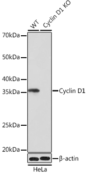 [KO Validated] Cyclin D1 Rabbit monoclonal antibody