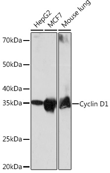 [KO Validated] Cyclin D1 Rabbit monoclonal antibody