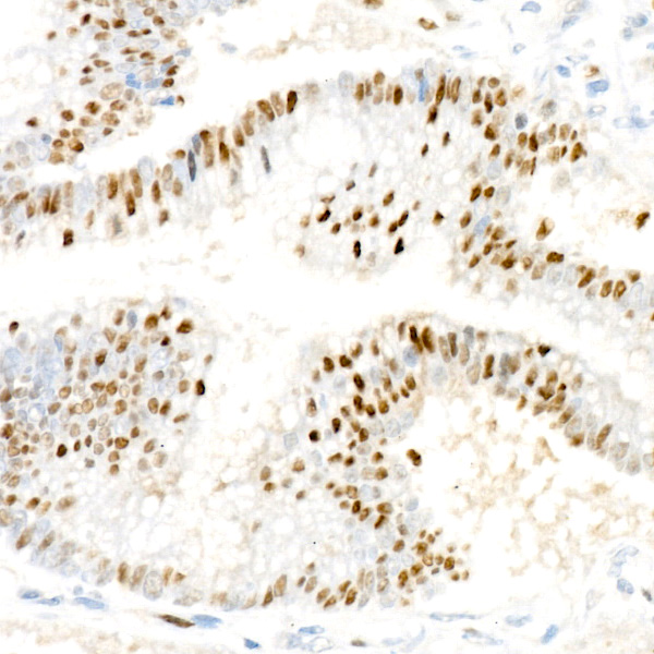 [KO Validated] Cyclin D1 Rabbit monoclonal antibody