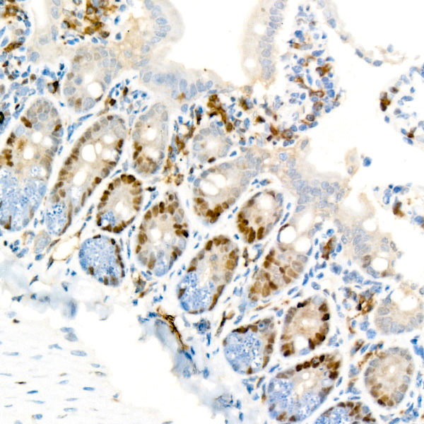 [KO Validated] Cyclin D1 Rabbit monoclonal antibody