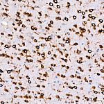 Western blot - Cytokeratin 14 (KRT14) Rabbit mAb (A19039)