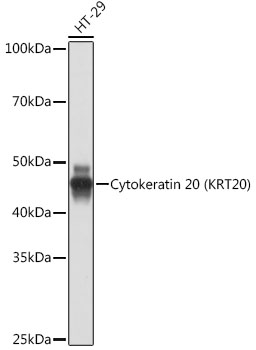 Cytokeratin 20 (CK20) Rabbit mAb
