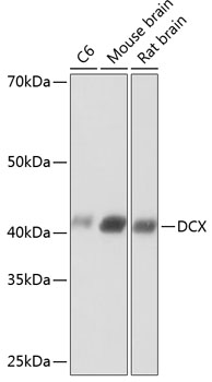 Doublecortin Rabbit mAb