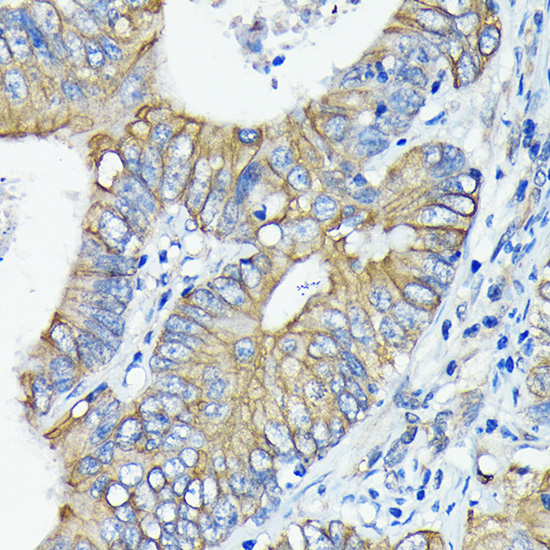 DR5/TRAILR2/TNFRSF10B Rabbit monoclonal antibody