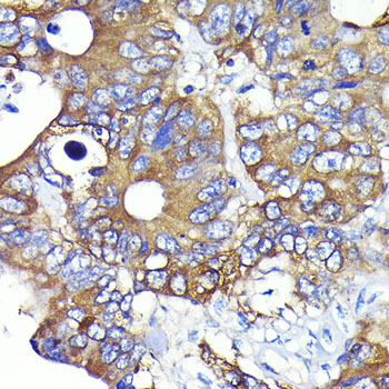Ezrin Rabbit monoclonal antibody