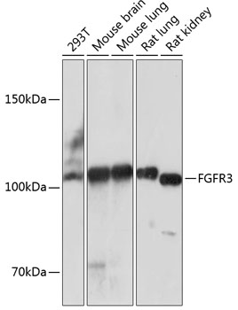 FGFR3 Rabbit monoclonal antibody