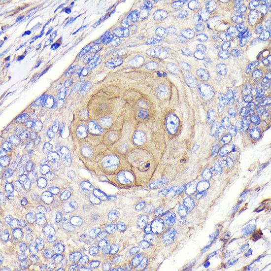 FGFR3 Rabbit monoclonal antibody