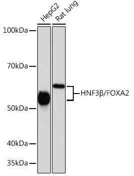 HNF3B Beta/FOXA2 Rabbit monoclonal antibody